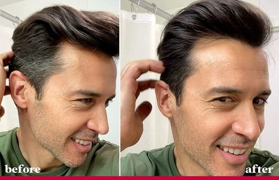 年紀(jì)輕輕就長白頭發(fā)？從沐浴用品到生活方式的全方位應(yīng)對指南